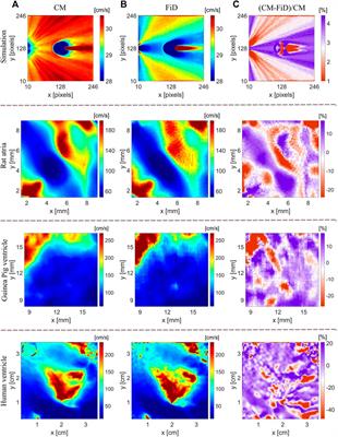 Circle Method for Robust Estimation of Local Conduction Velocity High-Density Maps From Optical Mapping Data: Characterization of Radiofrequency Ablation Sites